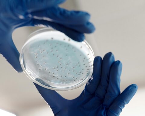 A blue-gloved researcher observes a petri dish of growing proteins.