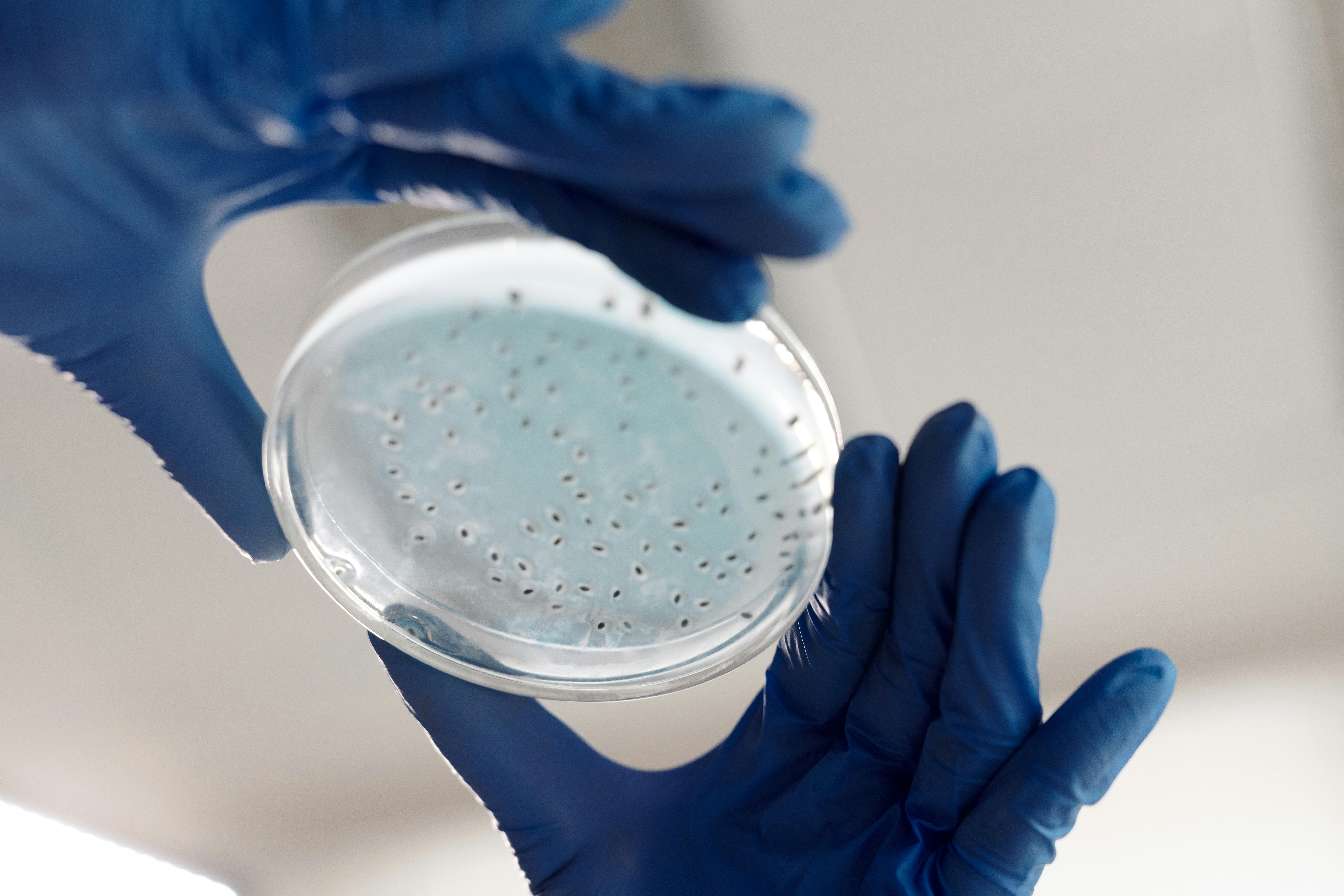 A blue-gloved researcher observes a petri dish of growing proteins.